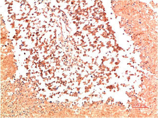 COL2A1 Monoclonal Antibody