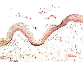 COL4A1 Monoclonal Antibody