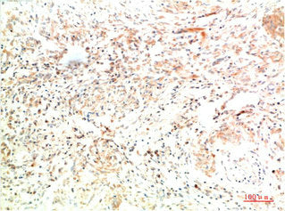 COL2A1 Monoclonal Antibody