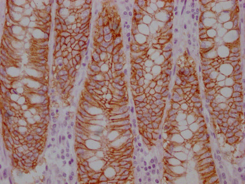EPCAM Monoclonal Antibody