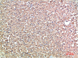 TTR Monoclonal Antibody