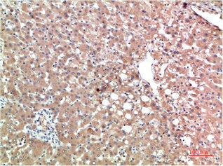 TTR Monoclonal Antibody