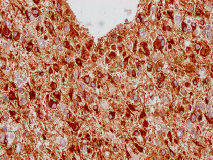 GFAP Monoclonal Antibody