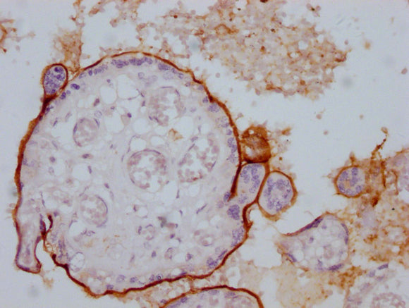ENG Monoclonal Antibody