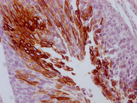 KRT13 Monoclonal Antibody