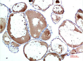 TTR Monoclonal Antibody