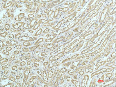 ACTN1 Monoclonal Antibody