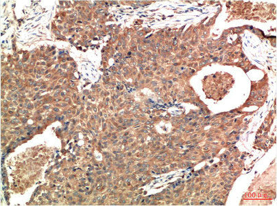 ATM Monoclonal Antibody