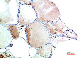 TTR Monoclonal Antibody