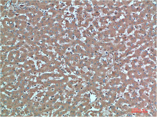 TTR Monoclonal Antibody