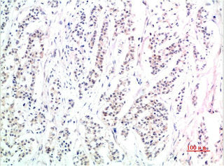 Phospho-SMAD3(S425) Monoclonal Antibody