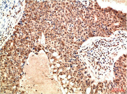 ATM Monoclonal Antibody