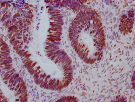 ESR1 Monoclonal Antibody