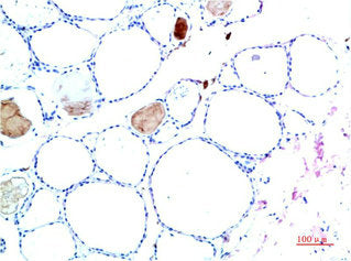 TTR Monoclonal Antibody