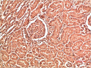 COL4A1 Monoclonal Antibody