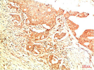 Acetyl-TP53(K382) Monoclonal Antibody