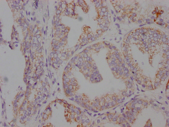 AMACR Monoclonal Antibody