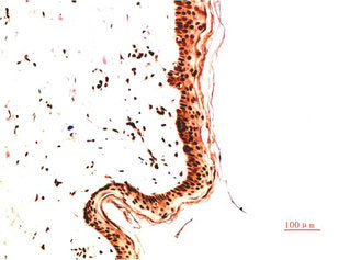 COL4A1 Monoclonal Antibody