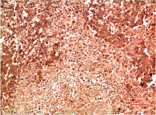MAPK14 Monoclonal Antibody