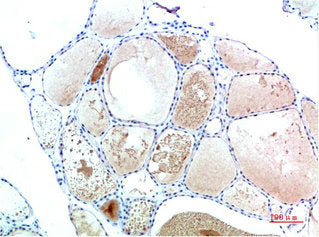 TTR Monoclonal Antibody