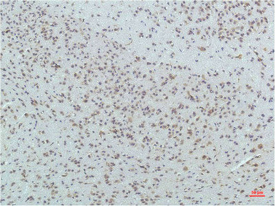 PPARD Monoclonal Antibody