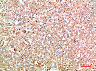 TTR Monoclonal Antibody