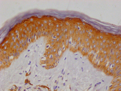 MERTNL Monoclonal Antibody