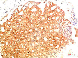 Acetyl-TP53(K382) Monoclonal Antibody
