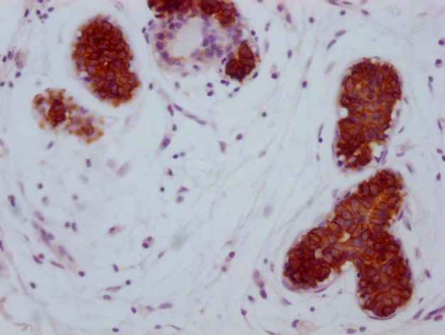 KRT15 Monoclonal Antibody