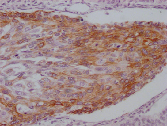 KRT14 Monoclonal Antibody