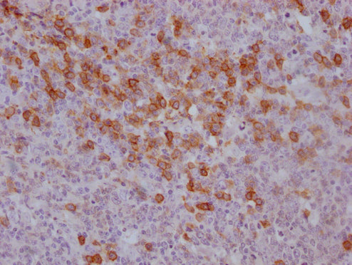 CD38 Monoclonal Antibody