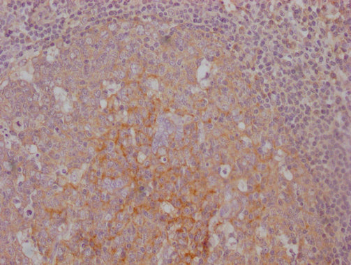 CD14 Monoclonal Antibody