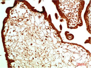 CBX5 Monoclonal Antibody