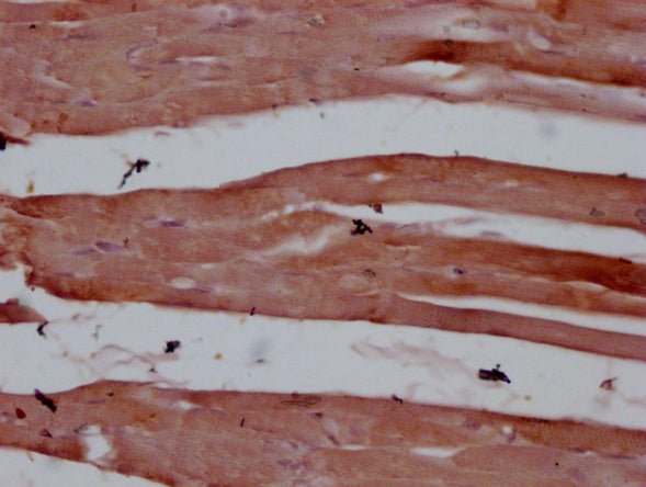 ACTC1/ACTA1/ACTG2 Monoclonal Antibody