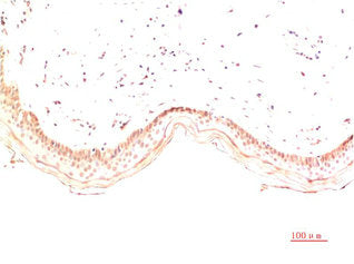 COL1A1 Monoclonal Antibody
