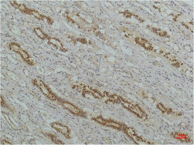 NFKBIB Monoclonal Antibody