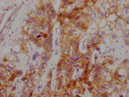 CTNNB1 Monoclonal Antibody