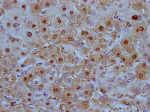 ARG1 Monoclonal Antibody