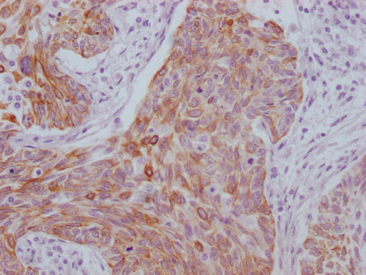 KRT6A Monoclonal Antibody
