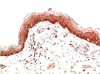COL1A1 Monoclonal Antibody