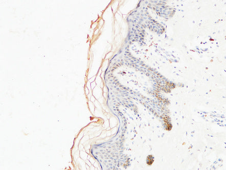 COL1A1 Monoclonal Antibody
