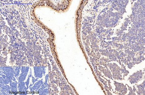 COL1A1 Monoclonal Antibody
