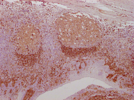 CD79A Monoclonal Antibody