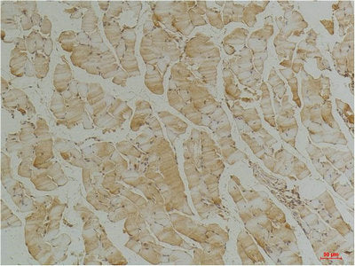 DES Monoclonal Antibody