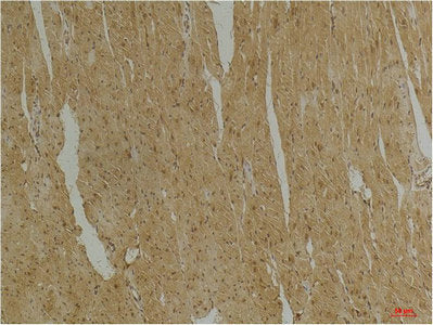 DES Monoclonal Antibody