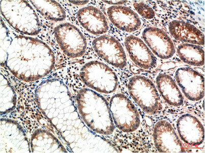 ATM Monoclonal Antibody