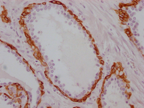 KRT17 Monoclonal Antibody