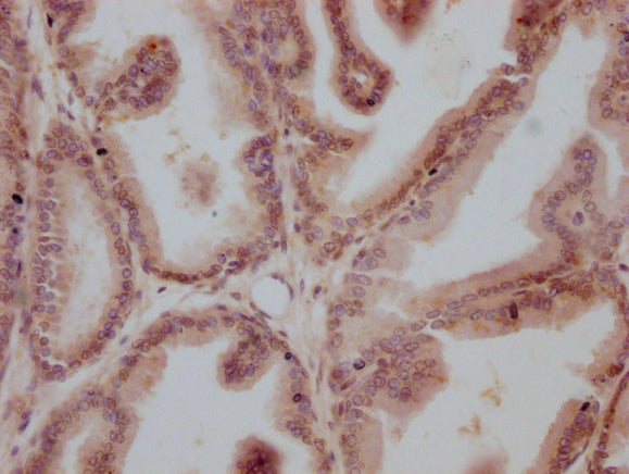 AR Monoclonal Antibody