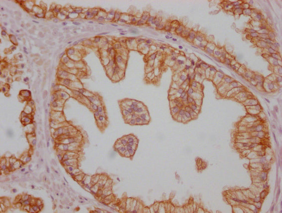 KRT8 Monoclonal Antibody