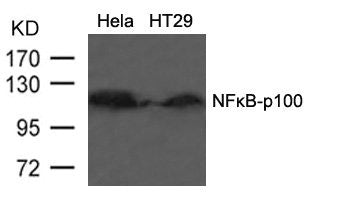 NFKB2 (Ab-866) Antibody